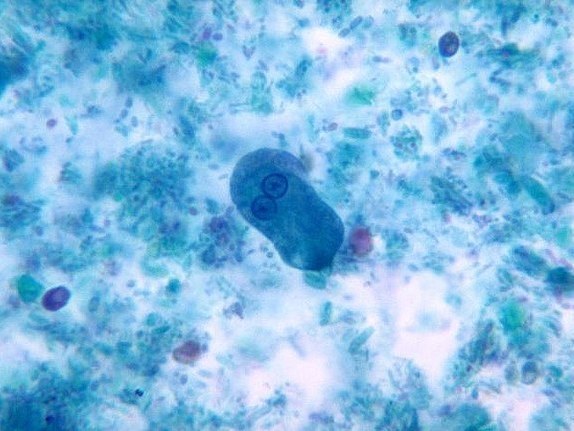 Entamoeba histolytica